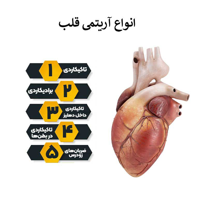 انواع آریتمی قلبی
